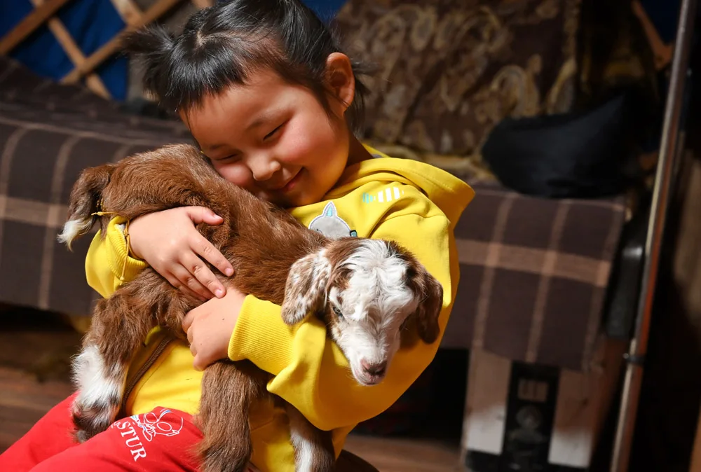 Sarnai is a 4-year-old girl from a nomadic family living in the countryside. She presented with a hemangioma (benign tumor) that was removed from her inner eyelid in April of 2022 by Dr. Battsetseg at Mother and Child Hospital (MCH), an Orbis partner hospital, in Ulaanbaatar.